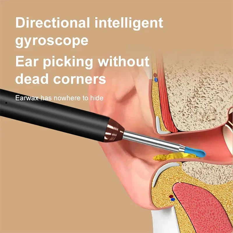 Tinsol Smart Visual Ear Cleaner Wireless WiFi Ear Pick Otoscope Camera